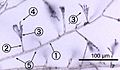 Penicillium labeled cropped