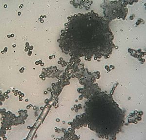 Rhizopus fungus