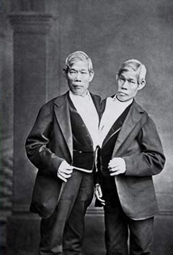 60-ish year old conjoined twin brothers wearing a suit and facing the camera