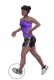 Mild motor-predominant PD