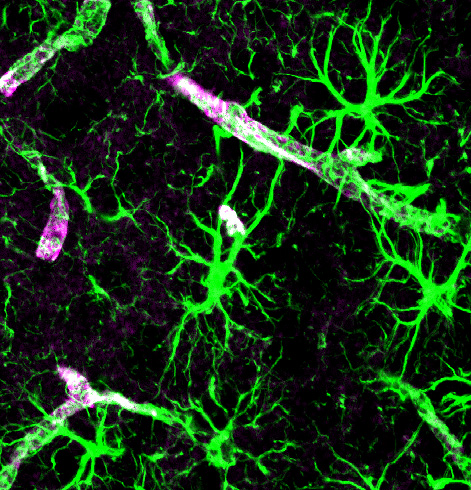 Astrocytes