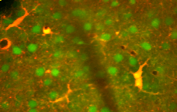 Astrocytes-mouse-cortex