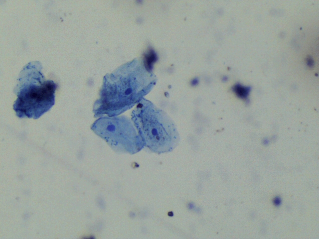 Nucleus in human cheek cells 3