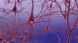 Alzheimer's disease-neuron death