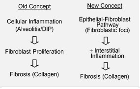 Concepts of IPF