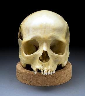 Caucasoid skull