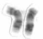 Human male karyotpe high resolution - Chromosome 17 cropped