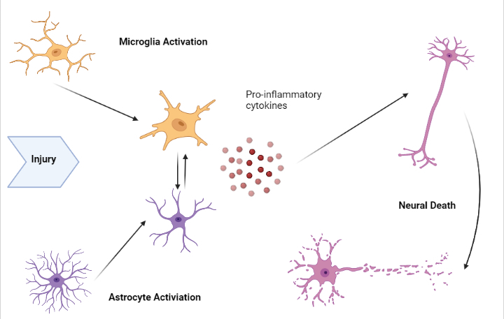 Neuroinflammation example