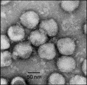 Electron micrograph of negatively stained Nam Dinh virus particles