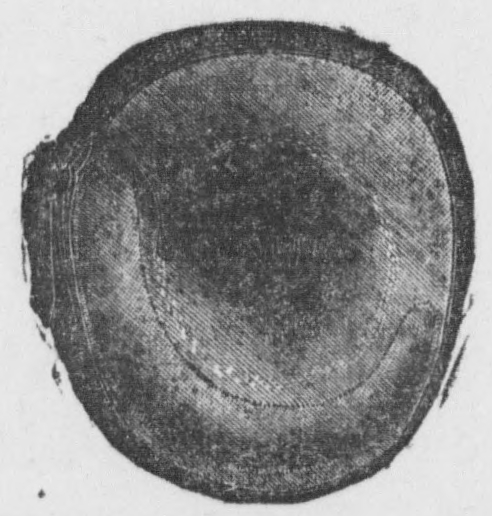 Catcher's mitt, 1904