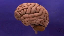 Alzheimers disease-brain shrinkage.gif