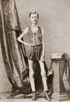 Isaac W Sprague, living skeleton, 1867.jpg