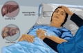 Depiction of a liver failure patient