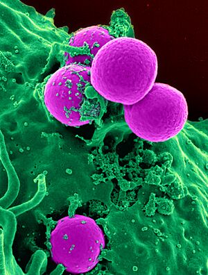 Human neutrophil ingesting MRSA