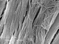Bertazzo S - SEM deproteined bone - wistar rat - x10k