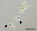 Cyanobacteria in symbiosis with a diatom