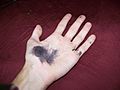 Silver nitrate stains