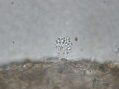 A zoosporangium of Phylctochytrium sp. on a duckweed frond. The zoosporangium is empty and the spines that had crowned it are folded back. Suspended above the empty zoosporangium is a mass of zoospores.