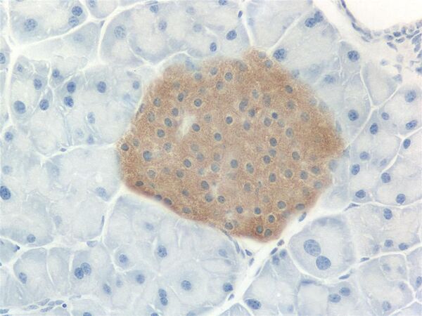 InsulinIHC