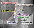 Iliopectineal line, ilioischial line, tear drop, acetabular fossa, and anterior and posterior wall of the acetabulumi