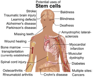 Stem cell treatments