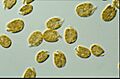 CSIRO ScienceImage 6736 dinoflagellate