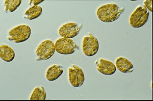 CSIRO ScienceImage 6736 dinoflagellate