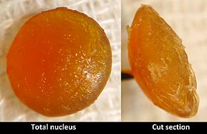 Nucleus of hypermature cataract with cut section