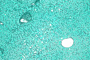 Liver reticulin