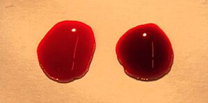 NIK 3232-Drops of blood medium