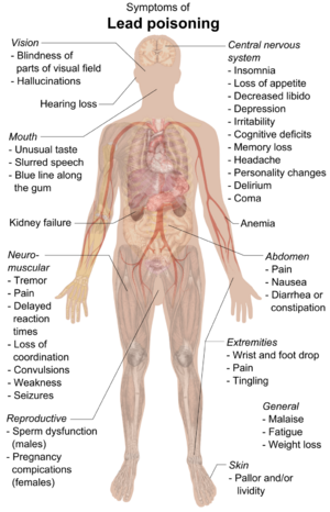 Symptoms of lead poisoning (raster)