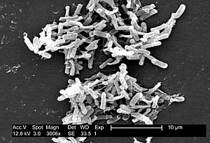 Clostridium difficile 01.jpg