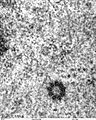 Spindle centriole - embryonic brain mouse - TEM