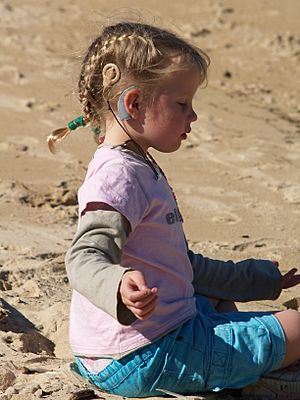 Child wearing Cochlear implant