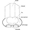 Rhinoplasty-nose diagram-nasal subunits-labelled