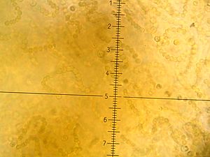 "Nostoc flagelliforme" under a microscope