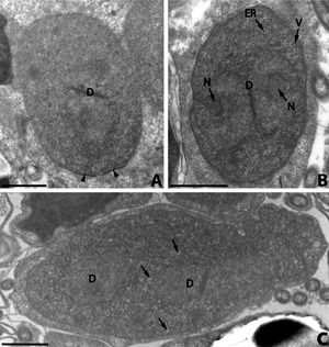 Parasite140019-fig2 Nosema podocotyloidis - Hyperparasitic Microsporidia