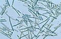 CSIRO ScienceImage 4203 A bluegreen algae species Cylindrospermum sp under magnification