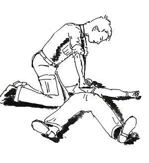 Illustration of cardiopulmonary resuscitation