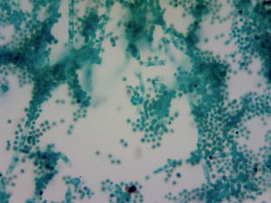 Penicillium spores