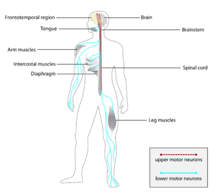 Diagram of a human nervous system highlighting the brain, spinal cord, motor neurons, and muscles of the body affected by ALS