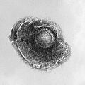 Varicella (Chickenpox) Virus PHIL 1878 lores