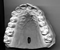 Upper Jaw Dentition
