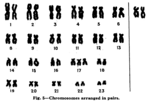 Fig 5, Edwards' 1960 Lancet paper - incorrectly depicts trisomy 17