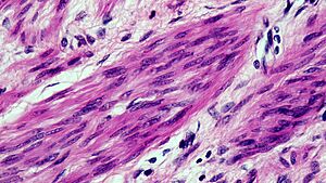Muscle Tissue Smooth (40087100000)