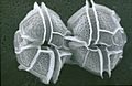 CSIRO ScienceImage 7609 SEM dinoflagellate