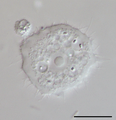 Parasite140120-fig3 Acanthamoeba keratitis Figure 3B