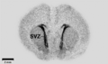 Autoradiography of a brain slice from an embryonal rat - PMID19190758 PLoS 0004371