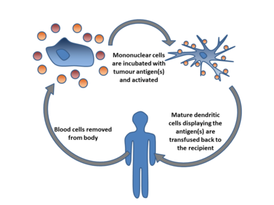 Dendritic cell therapy