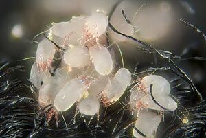 House dust mites (5247397771)